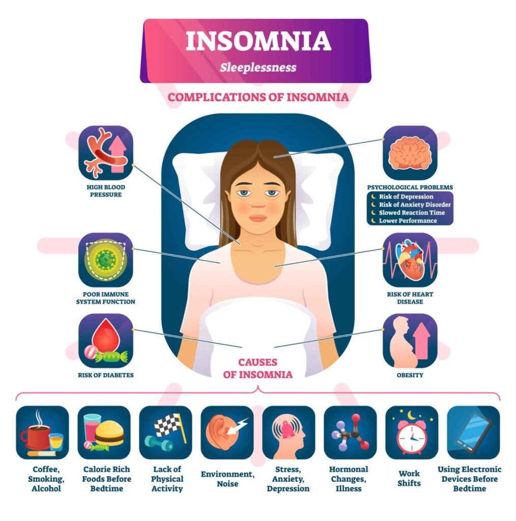 An info graphic of chronic insomnia disorder showing the stages of sleep, or lack there of.