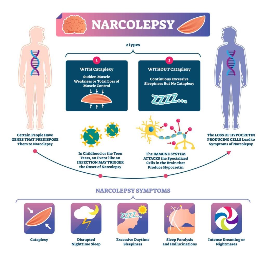 A vector graphic showing Narcolepsy Type 2 and type 1