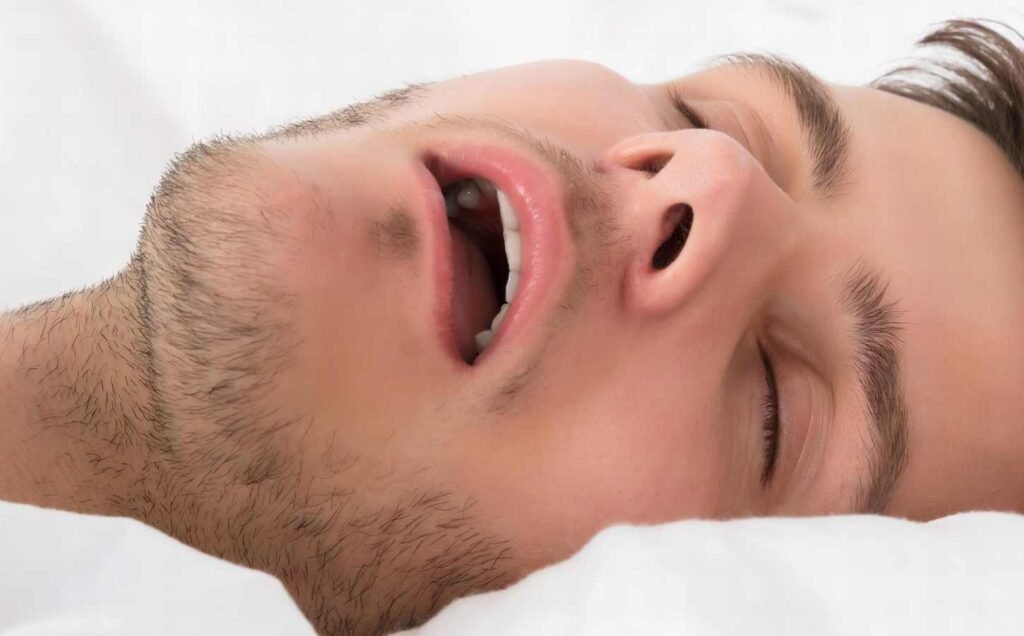 Close up of a young man snoring while asleep in bed, experiencing Obstructive Sleep Apnea.