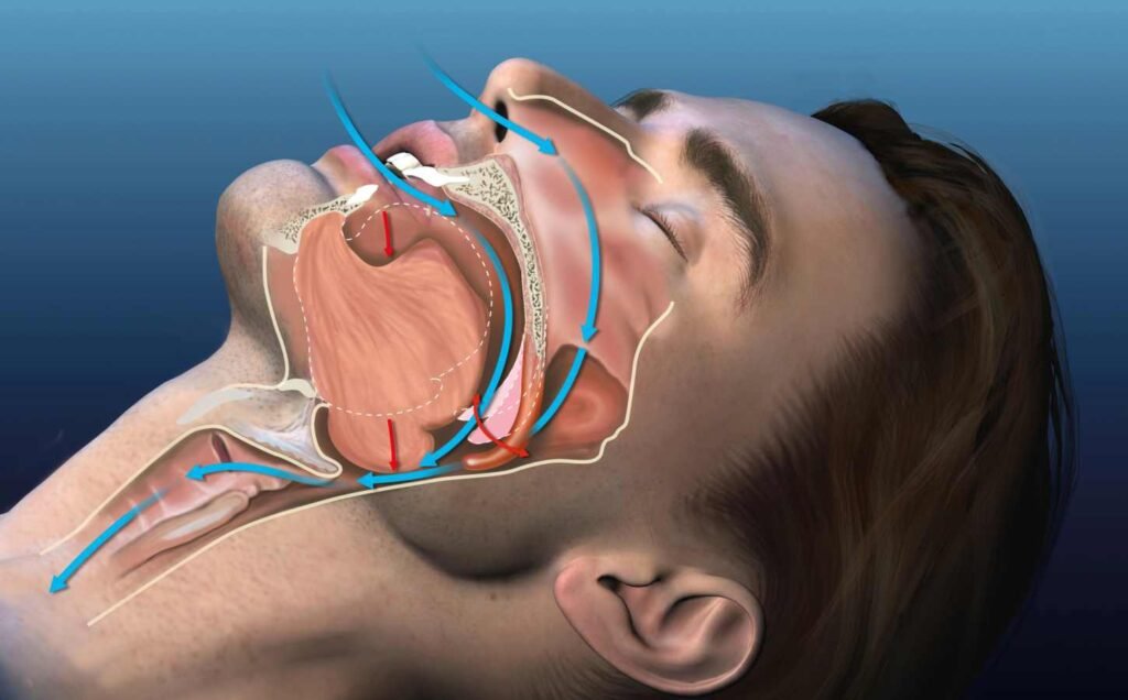 A 3D illustration of snoring male. Shows the passage ways and breathing process.