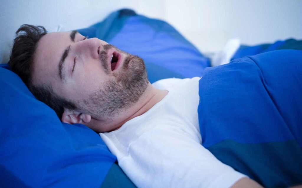 Close up of a man sleeping on his back with mouth open snoring because of hypopena.